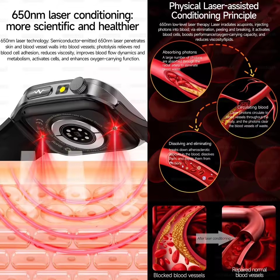 2026 neue Gesundheit Smart Wat – Industrial Laser Beam Bewertung und Preis